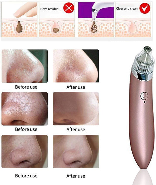 منظف لمسام الوجه